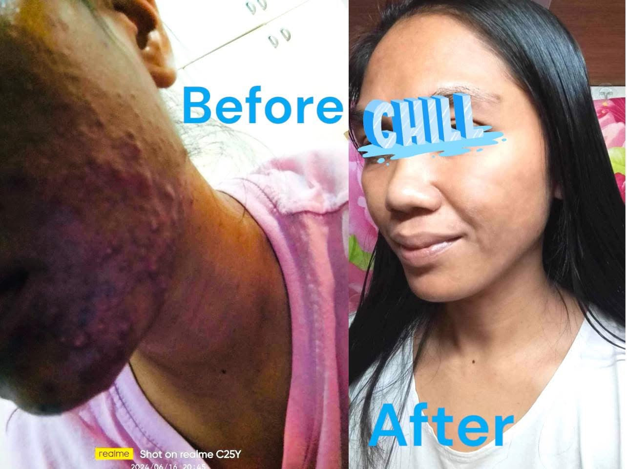 Kojic Acid Niacinamide Organic allin1 miracle soap effective for Melasma, Pimples, Darks Spots, Smooth and Soft Skin, Glass skin&whitening effect, skin diseases, allergies dandruff, feminine hygiene face and body and many more skin benefits.(135grams)
