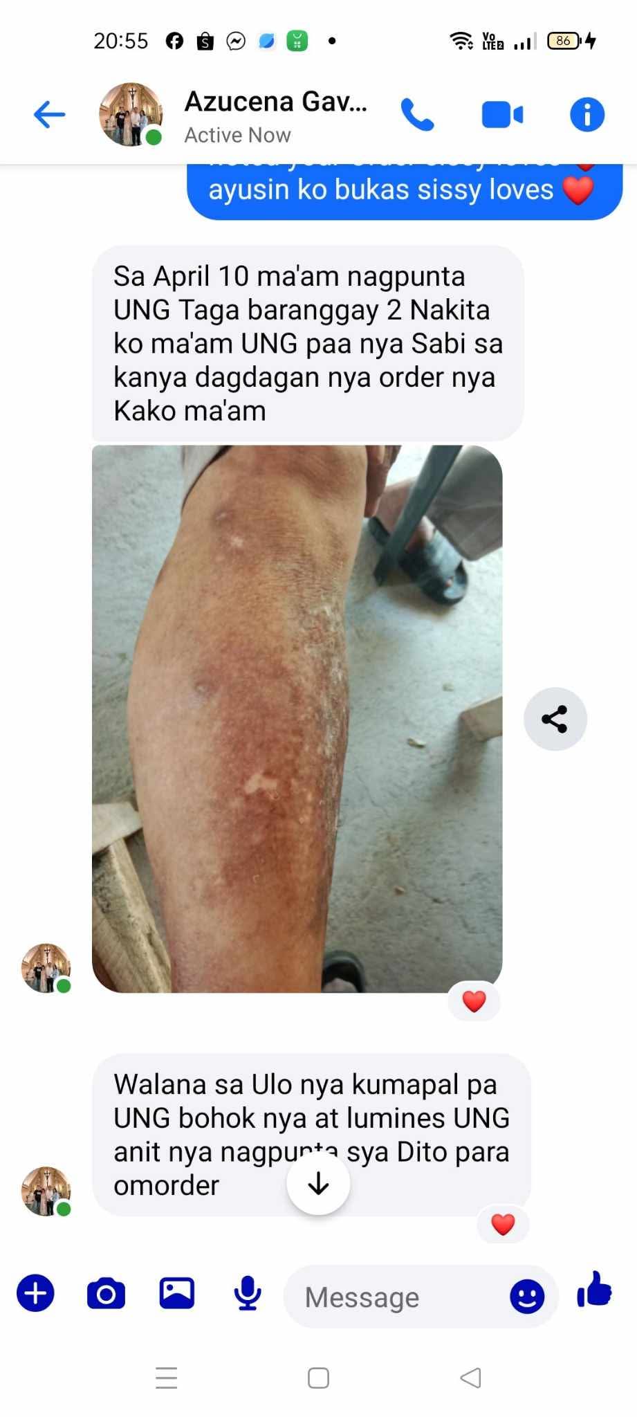 Kojic Acid Niacinamide Organic allin1 miracle soap effective for Melasma, Pimples, Darks Spots, Smooth and Soft Skin, Glass skin&whitening effect, skin diseases, allergies dandruff, feminine hygiene face and body and many more skin benefits.(135grams)