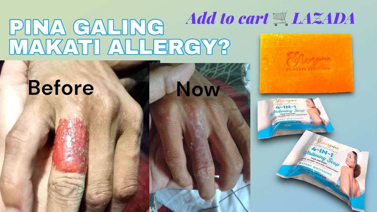 Organic niacinamide all in 1 miracle soap face&body all skin types kids and adults.(135grams)