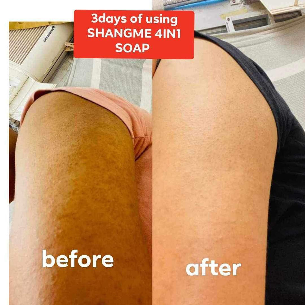 Organic niacinamide all in 1 miracle soap face&body all skin types kids and adults.(135grams)