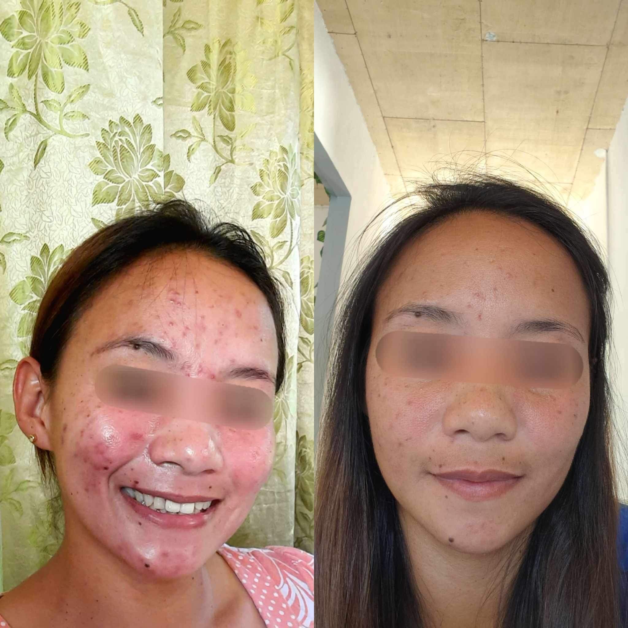 Organic niacinamide all in 1 miracle soap face&body all skin types kids and adults.(135grams)