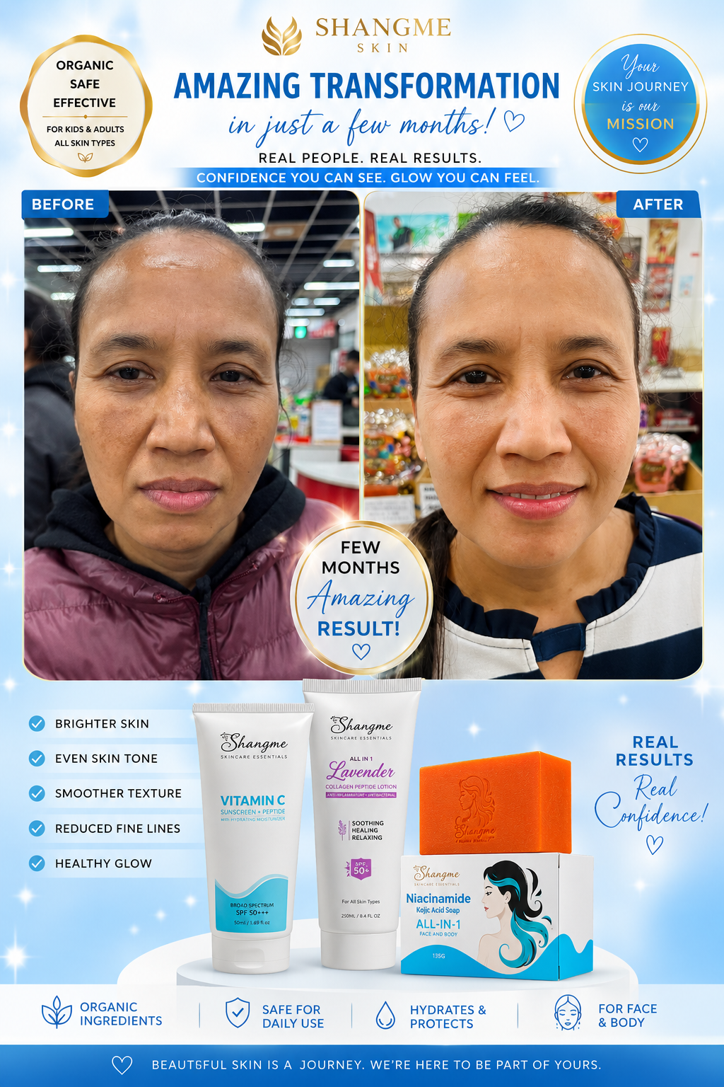 Shangme Skin Complete Care Bundle Set – Niacinamide Kojic Soap + Vitamin C Sunscreen Moisturizer + Lavender Collagen Peptide Lotion | Organic Skincare for Face & Body