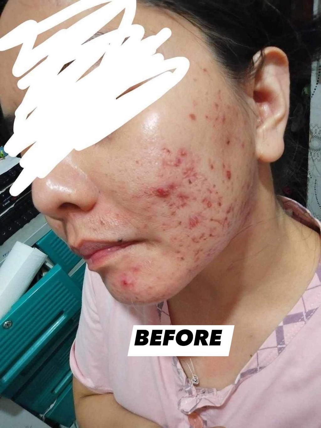 Organic niacinamide all in 1 miracle soap face&body all skin types kids and adults.(135grams)