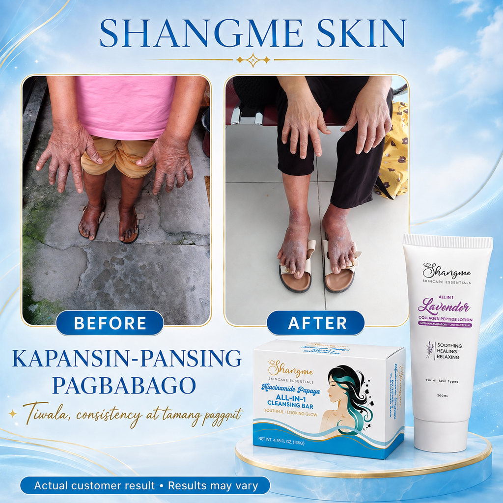 Shangme Skin Complete Care Set - Soap Sunscreen & Lotion