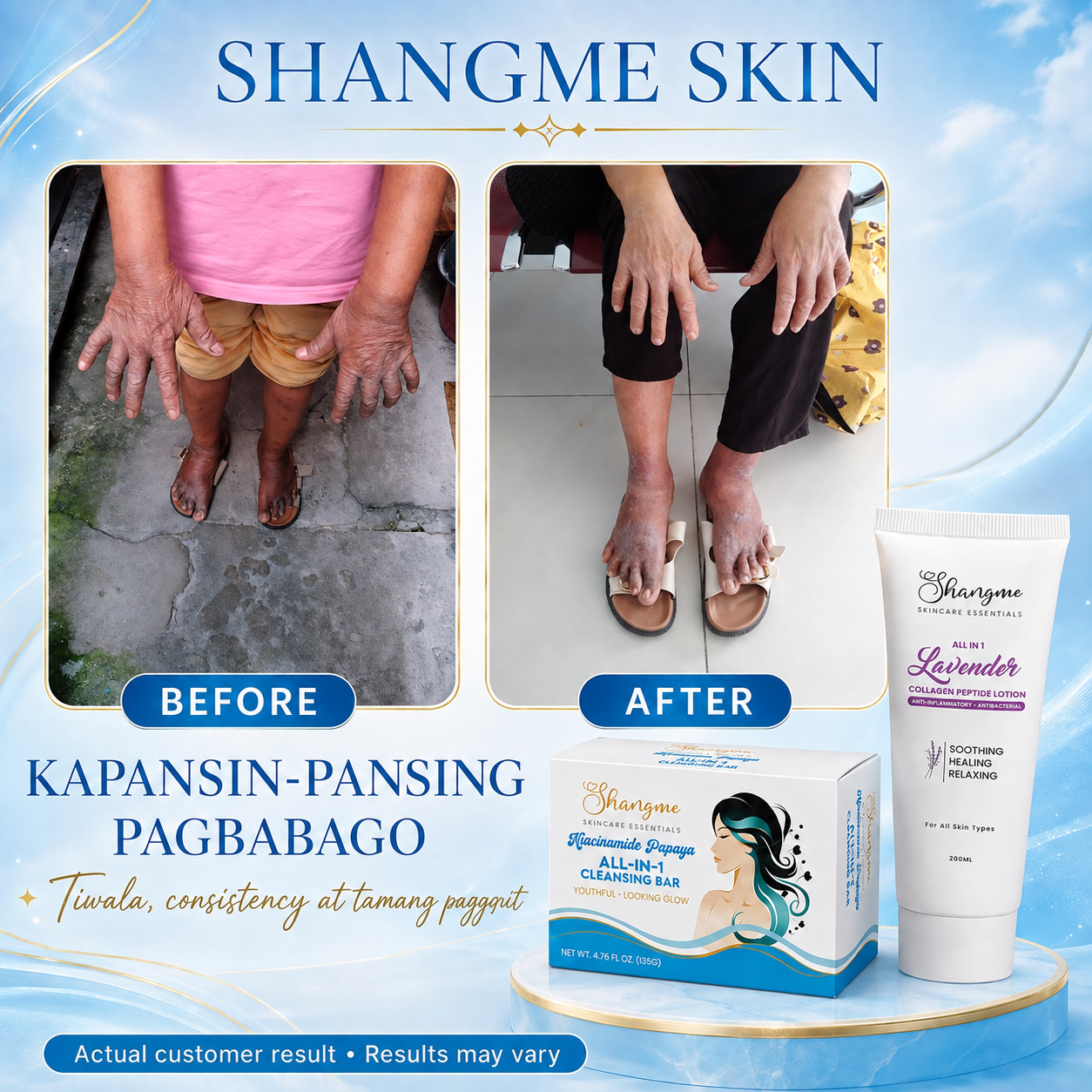 Shangme Skin Complete Care Set - Soap Sunscreen & Lotion