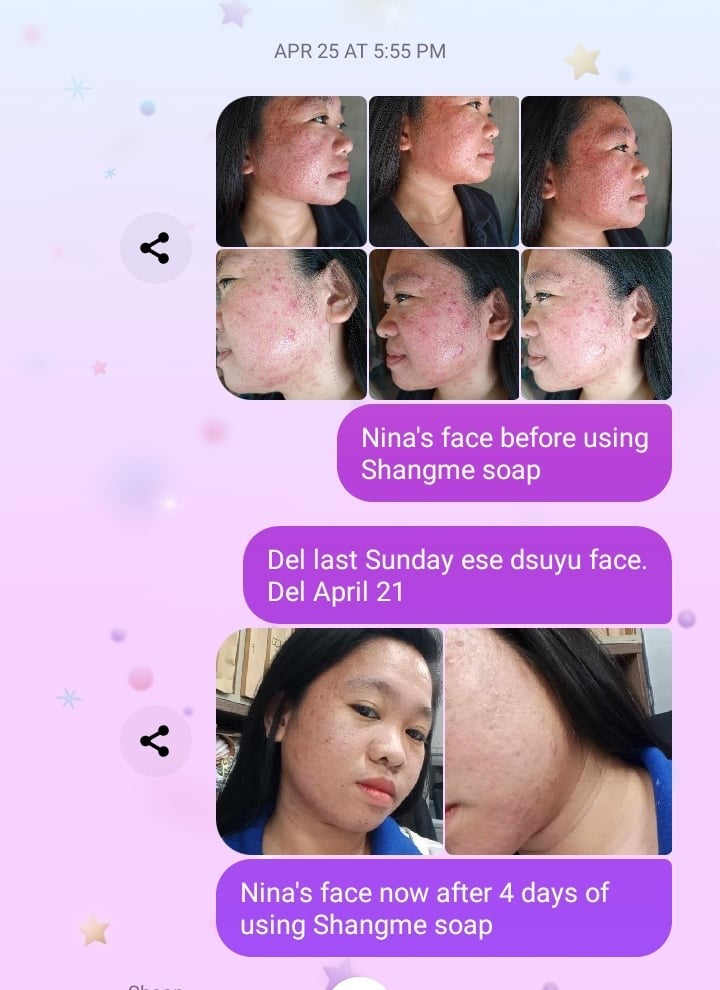 Organic niacinamide all in 1 miracle soap face&body all skin types kids and adults.(135grams)