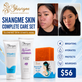 Complete Skincare Set | Kojic Soap, SPF 50+ Sunscreen & Body Lotion
