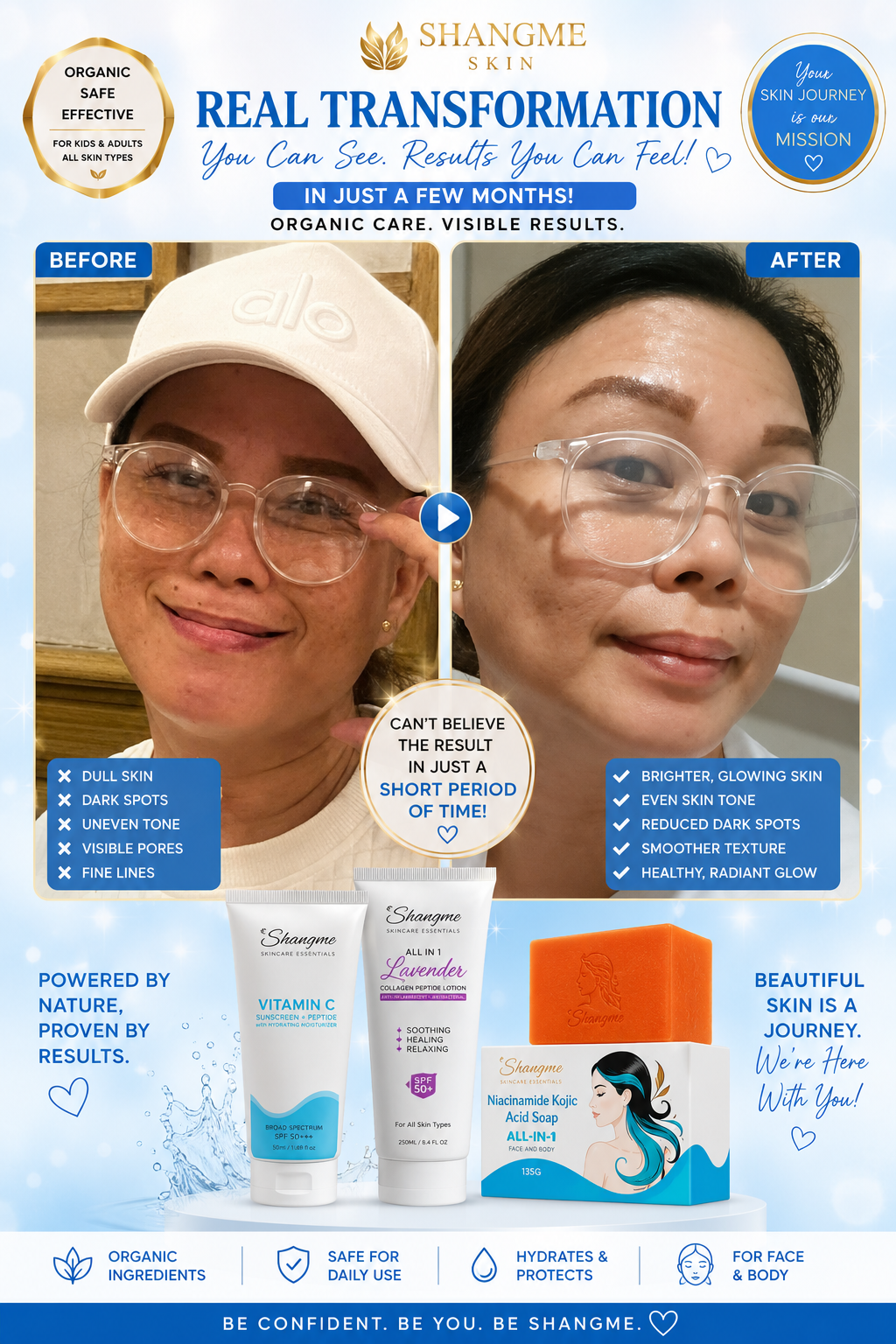 Shangme Skin Complete Care Bundle Set – Niacinamide Kojic Soap + Vitamin C Sunscreen Moisturizer + Lavender Collagen Peptide Lotion | Organic Skincare for Face & Body