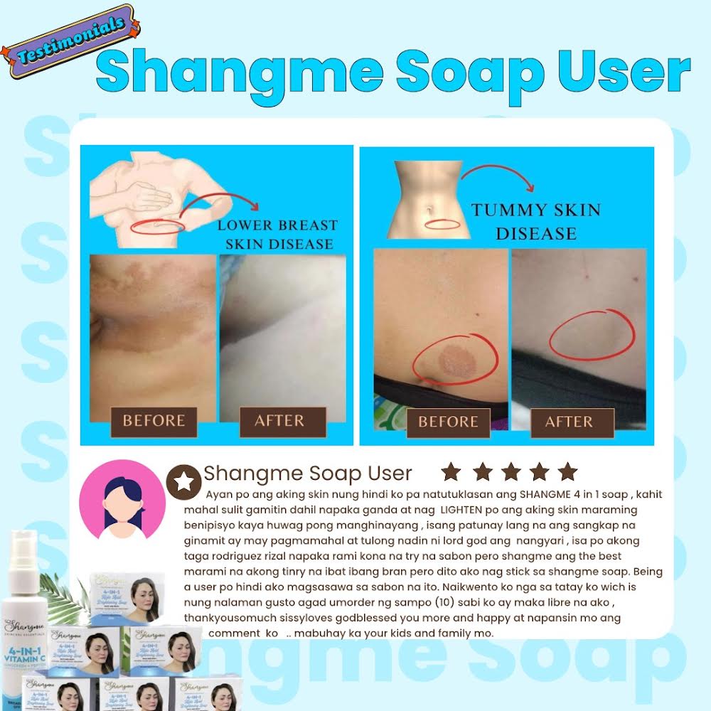 Organic niacinamide all in 1 miracle soap face&body all skin types kids and adults.(135grams)