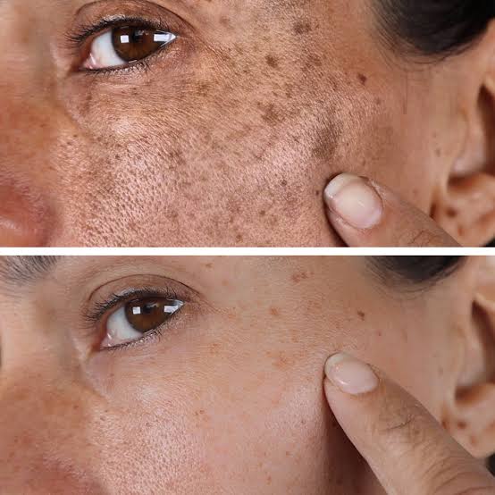 Shangme allin1 Sunscreen Moisturizer Collagen Peptide and Vitamin C