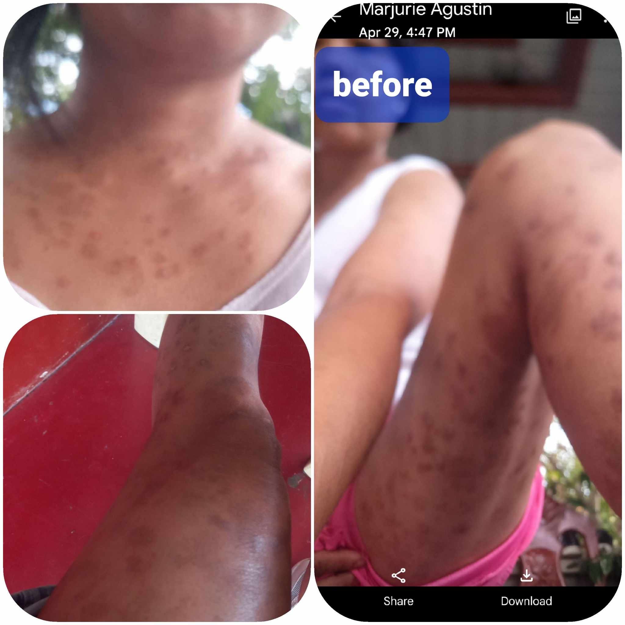 Organic niacinamide all in 1 miracle soap face&body all skin types kids and adults.(135grams)
