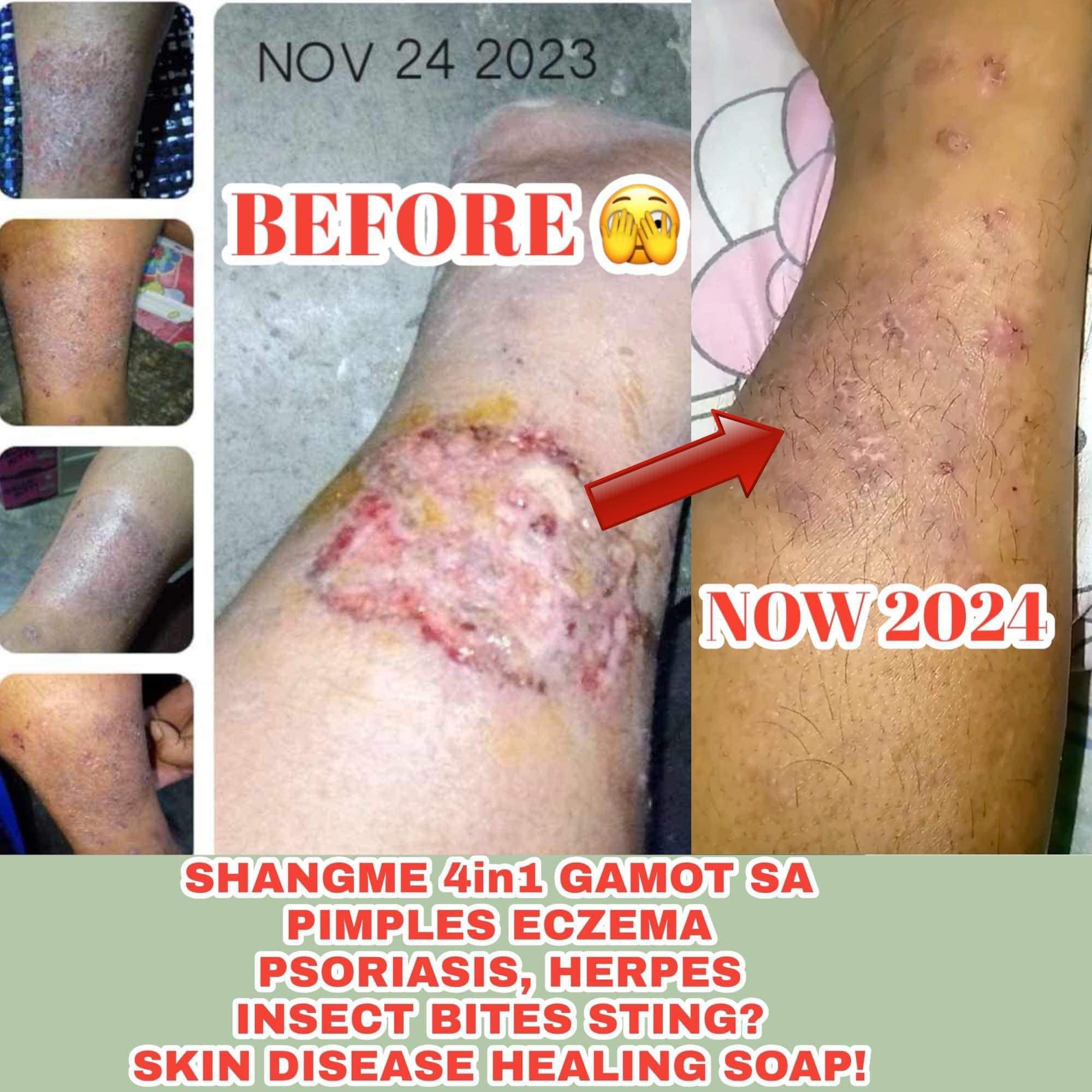 Organic niacinamide all in 1 miracle soap face&body all skin types kids and adults.(135grams)