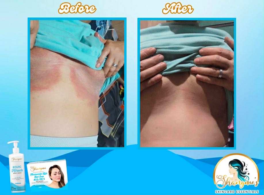 Organic niacinamide all in 1 miracle soap face&body all skin types kids and adults.(135grams)