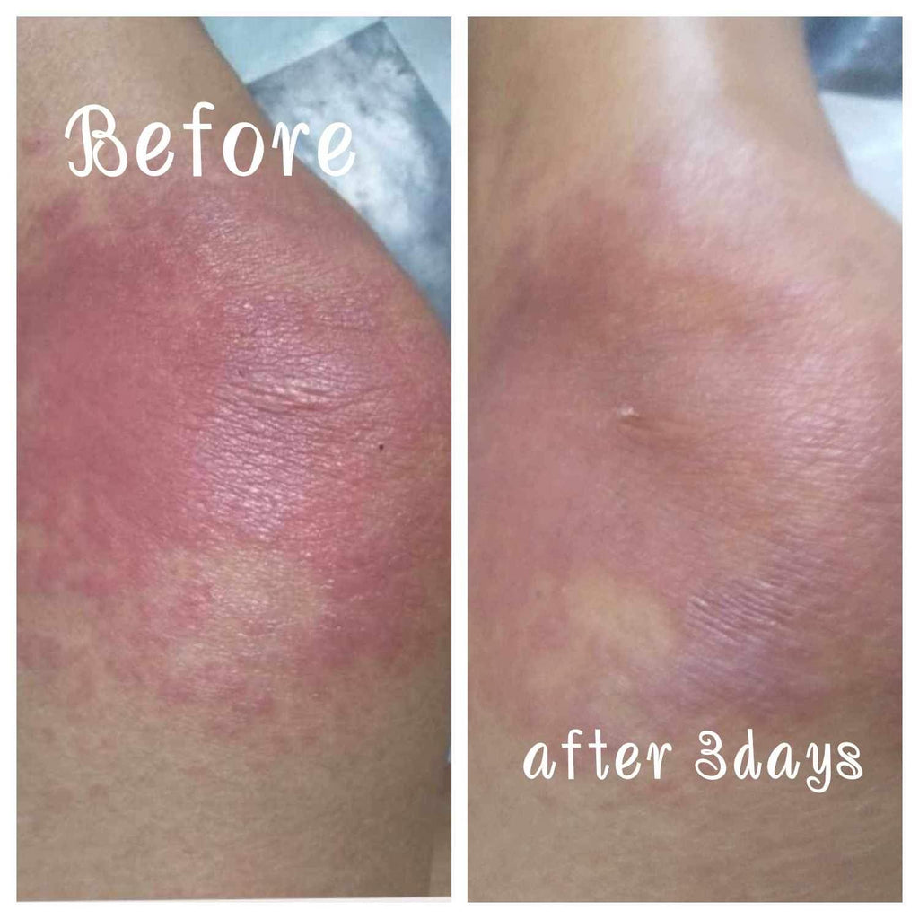 Organic niacinamide all in 1 miracle soap face&body all skin types kids and adults.(135grams)