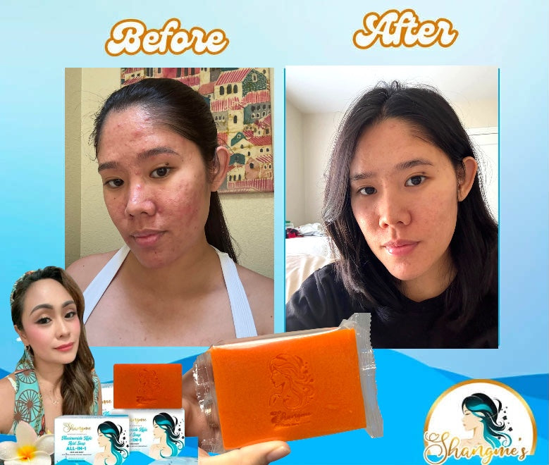 Organic niacinamide all in 1 miracle soap face&body all skin types kids and adults.(135grams)