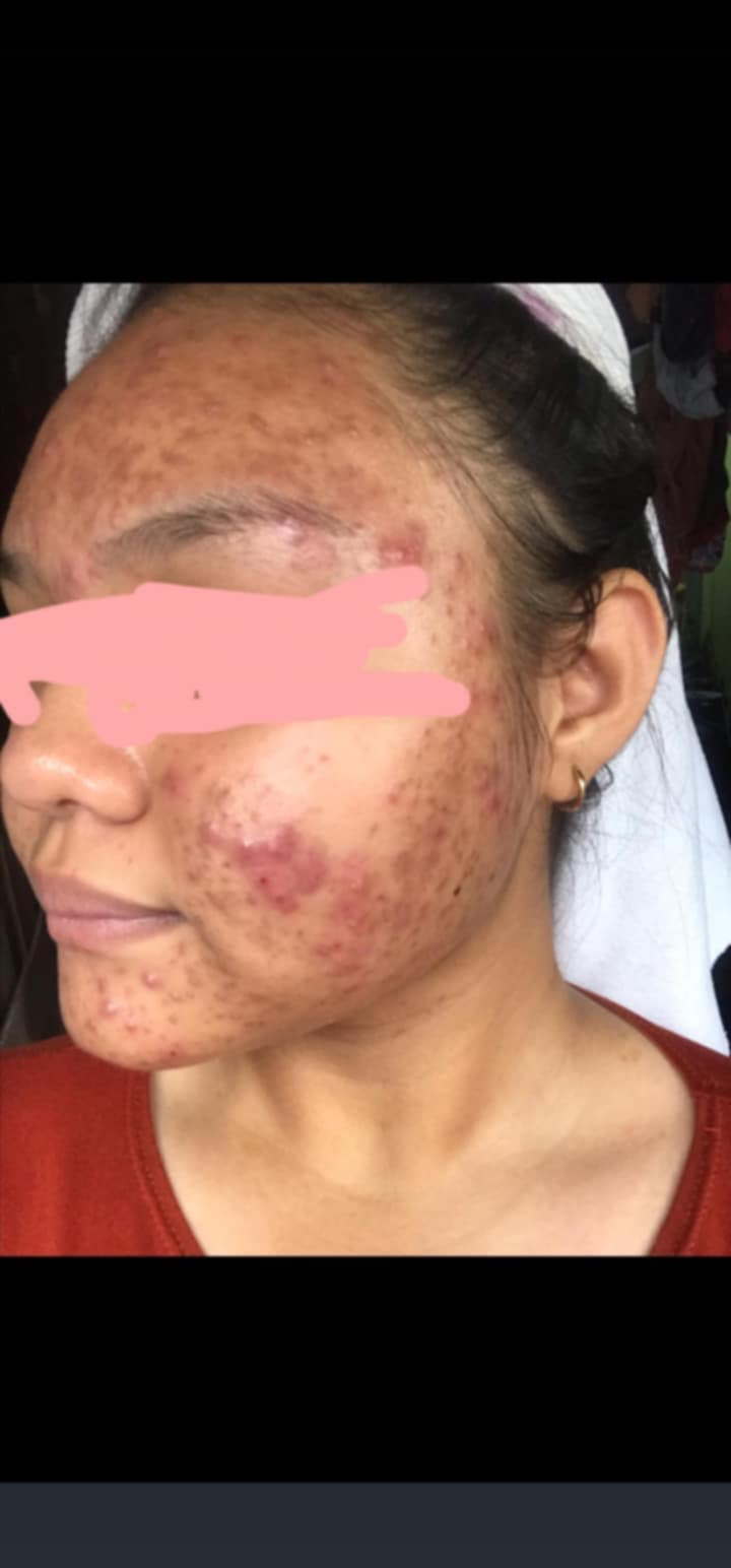 Organic niacinamide all in 1 miracle soap face&body all skin types kids and adults.(135grams)