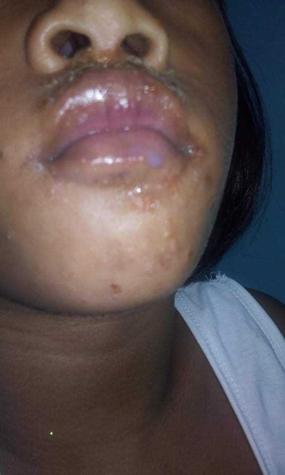 Organic niacinamide all in 1 miracle soap face&body all skin types kids and adults.(135grams)
