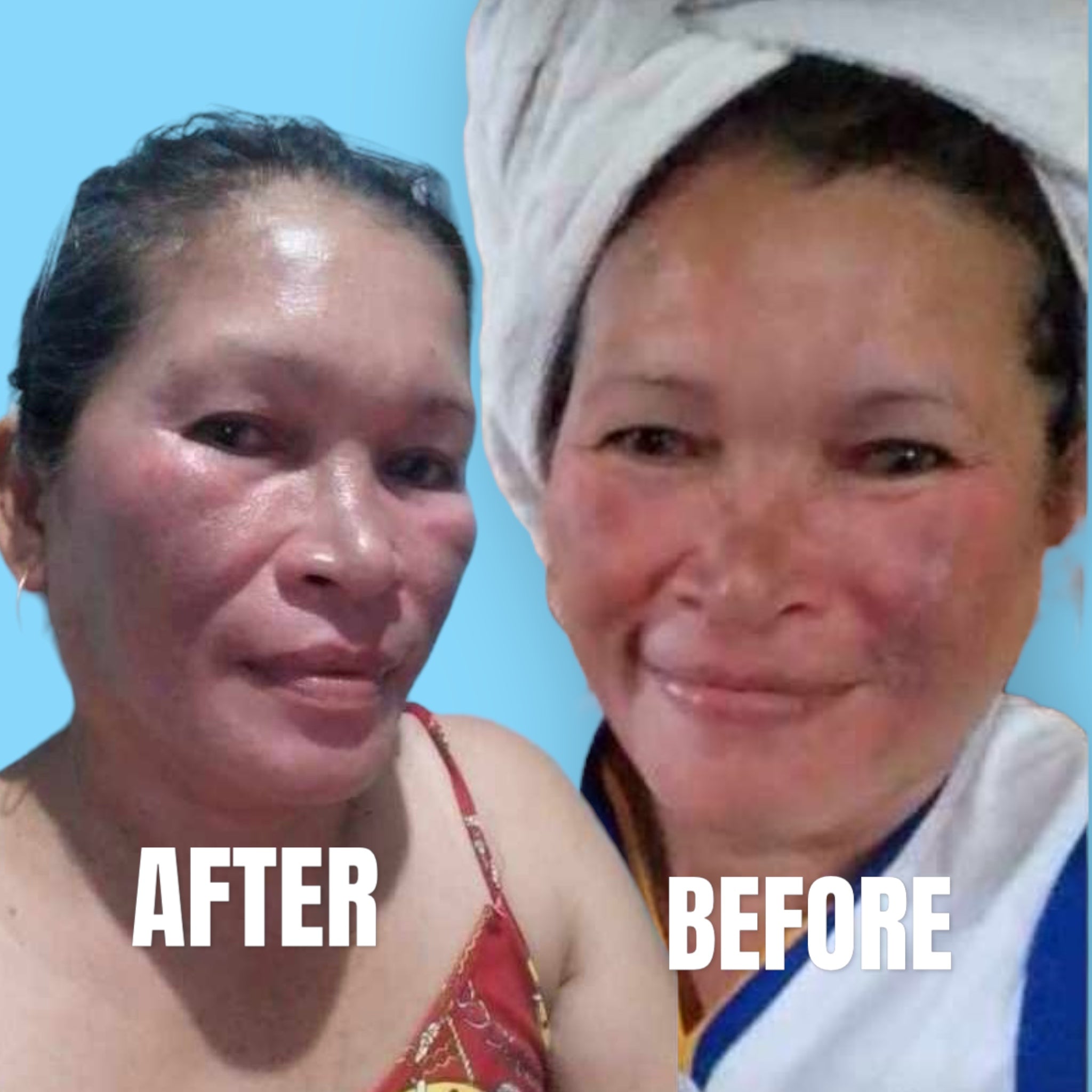 Organic niacinamide all in 1 miracle soap face&body all skin types kids and adults.(135grams)