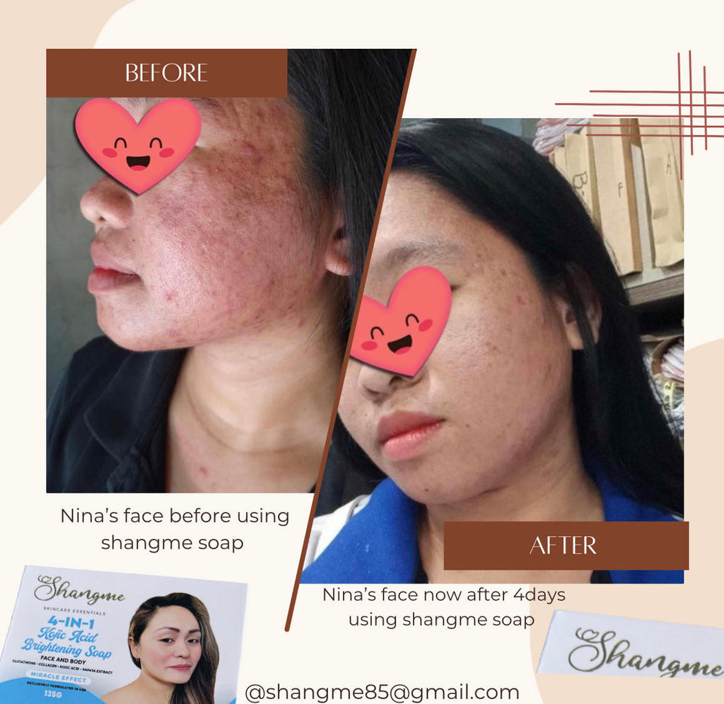 Organic niacinamide all in 1 miracle soap face&body all skin types kids and adults.(135grams)