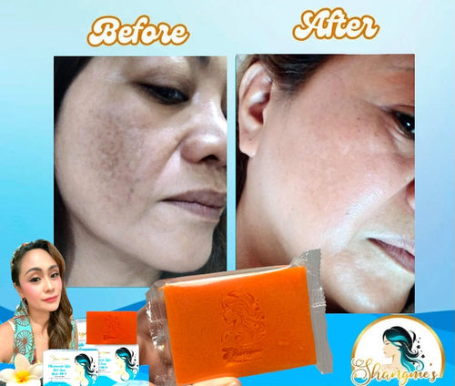 Shangme Face Set | Niacinamide Kojic Papaya Soap (135g) + Vitamin C Sunscreen & Peptide Moisturizer SPF 50+++ (50ml) | Daily Brightening & Hydrating Skincare Set
