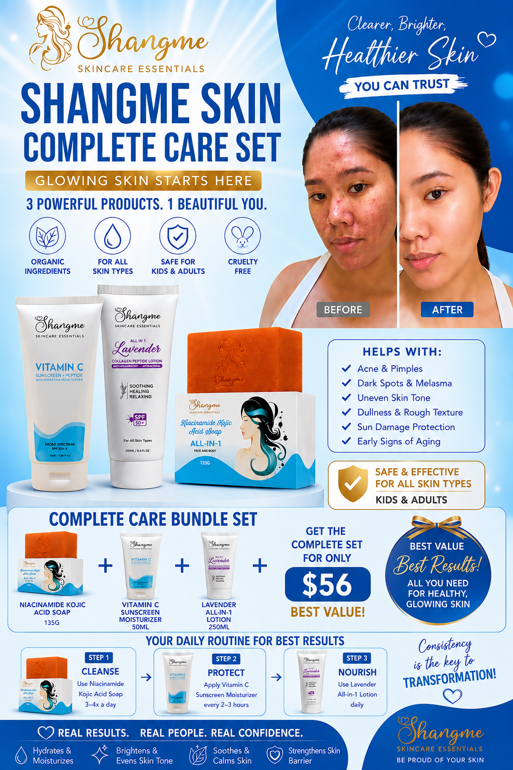 Shangme Skin Complete Care Bundle Set – Niacinamide Kojic Soap + Vitamin C Sunscreen Moisturizer + Lavender Collagen Peptide Lotion | Organic Skincare for Face & Body