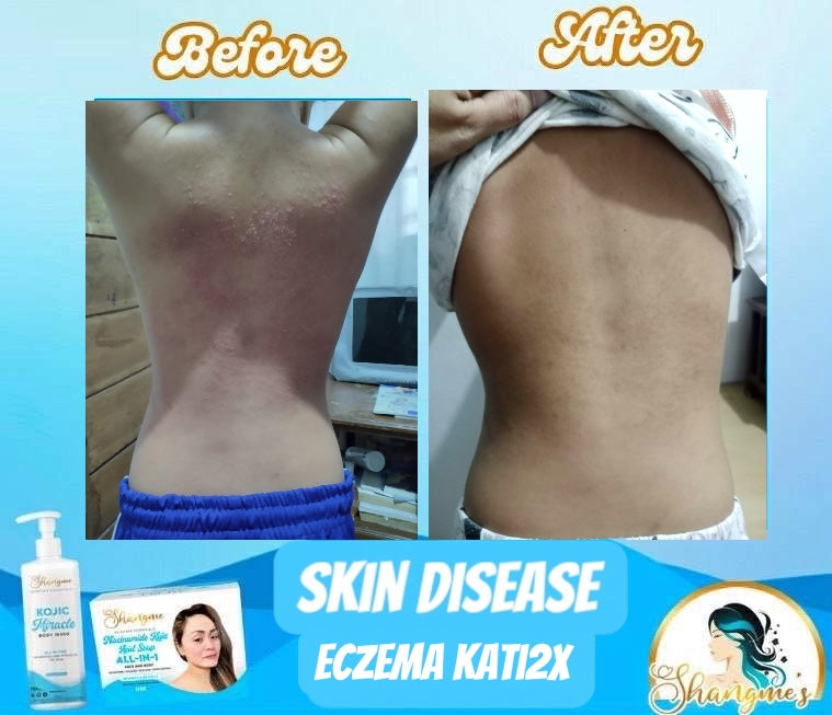 Organic niacinamide all in 1 miracle soap face&body all skin types kids and adults.(135grams)