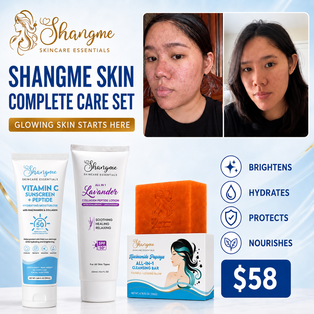 Shangme Skin Complete Care Set - Soap Sunscreen & Lotion