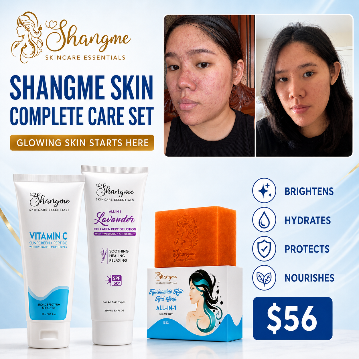 Shangme Skin Complete Care Set – Niacinamide Kojic Soap + Vitamin C Sunscreen Moisturizer + Lavender Collagen Peptide Lotion | Organic Skincare for Face & Body