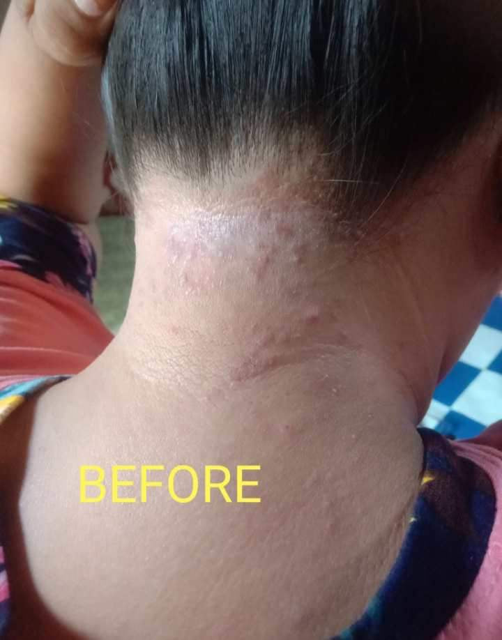 Organic niacinamide all in 1 miracle soap face&body all skin types kids and adults.(135grams)