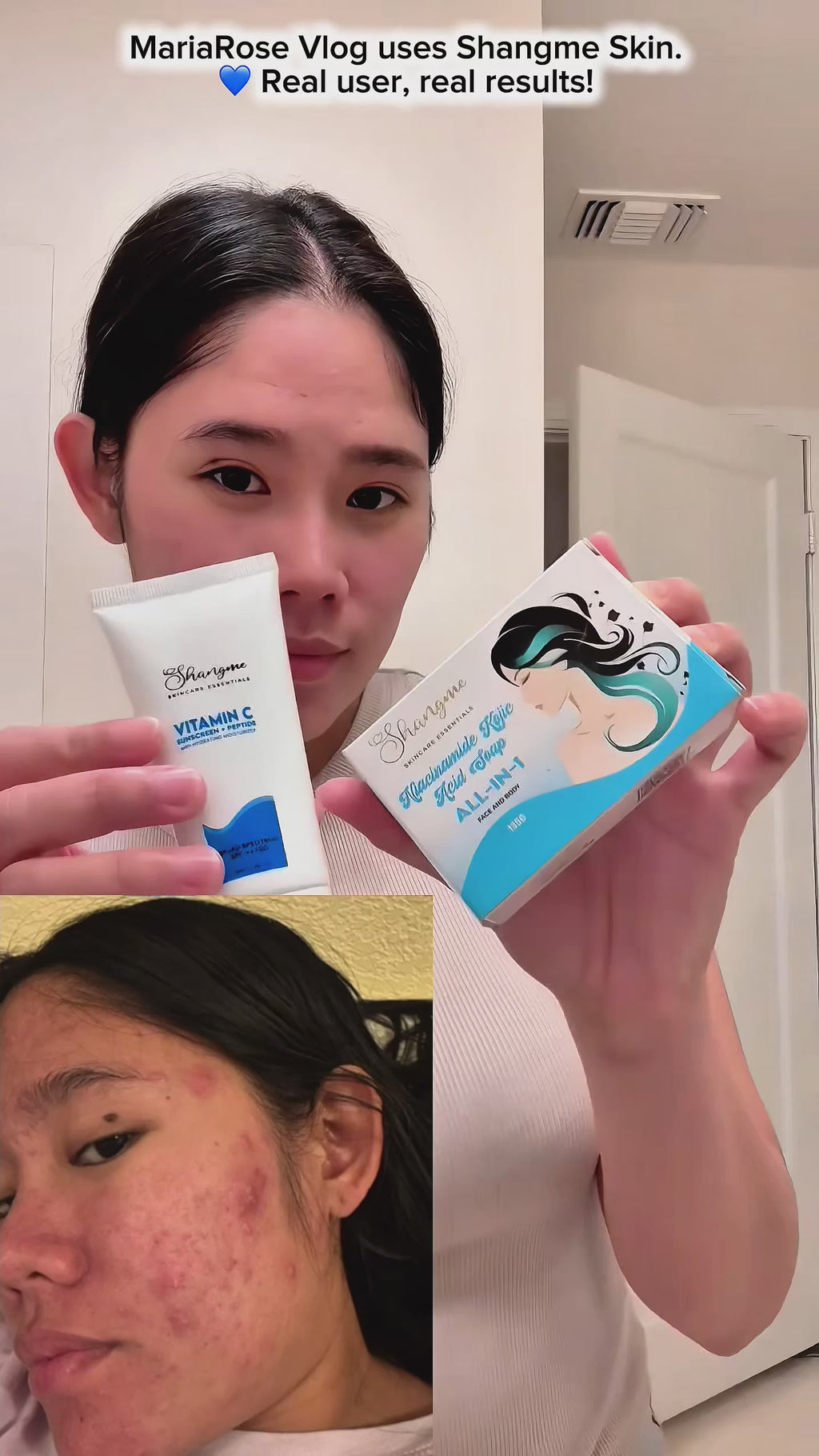 Shangme Face Set | Kojic Papaya Soap & SPF 50+ Sunscreen
